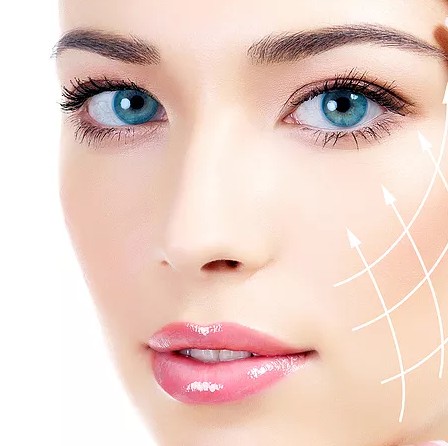 Facelift